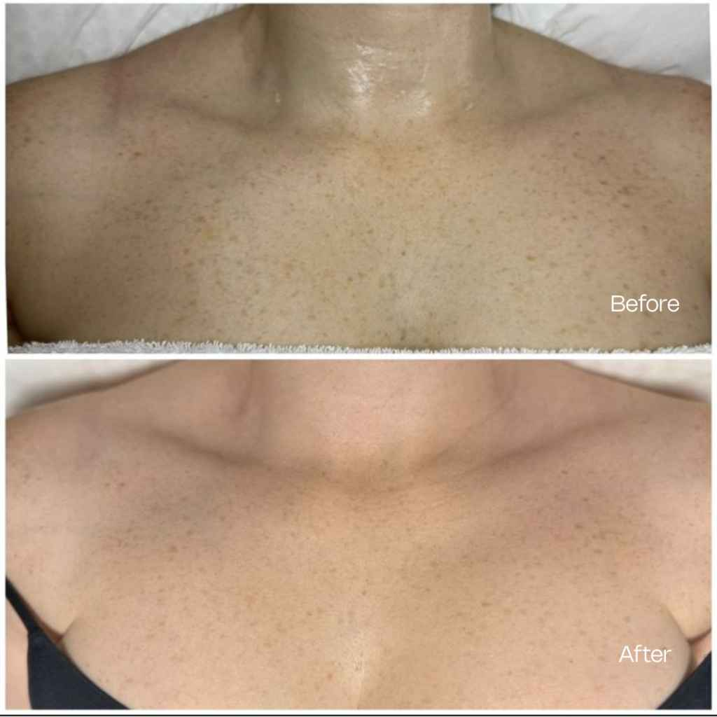 Treatment result 6