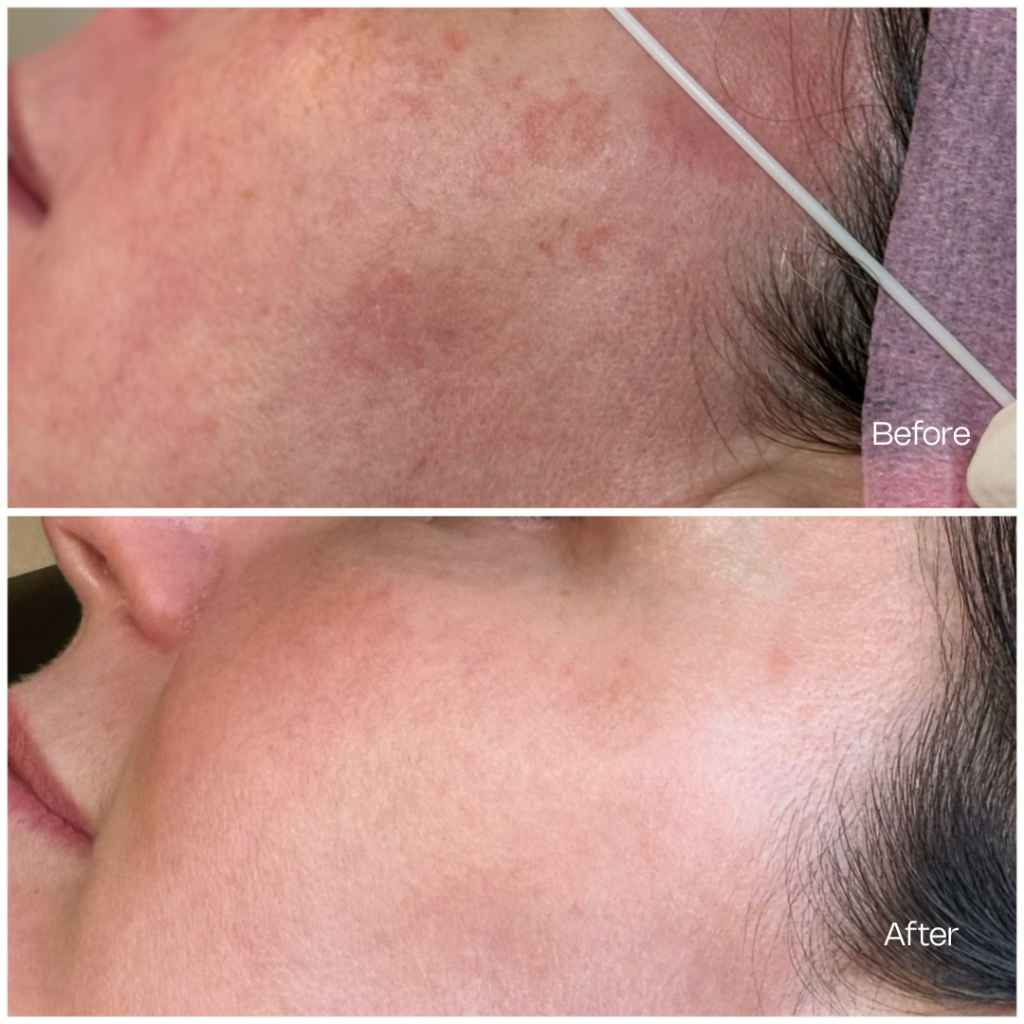 Treatment result 5