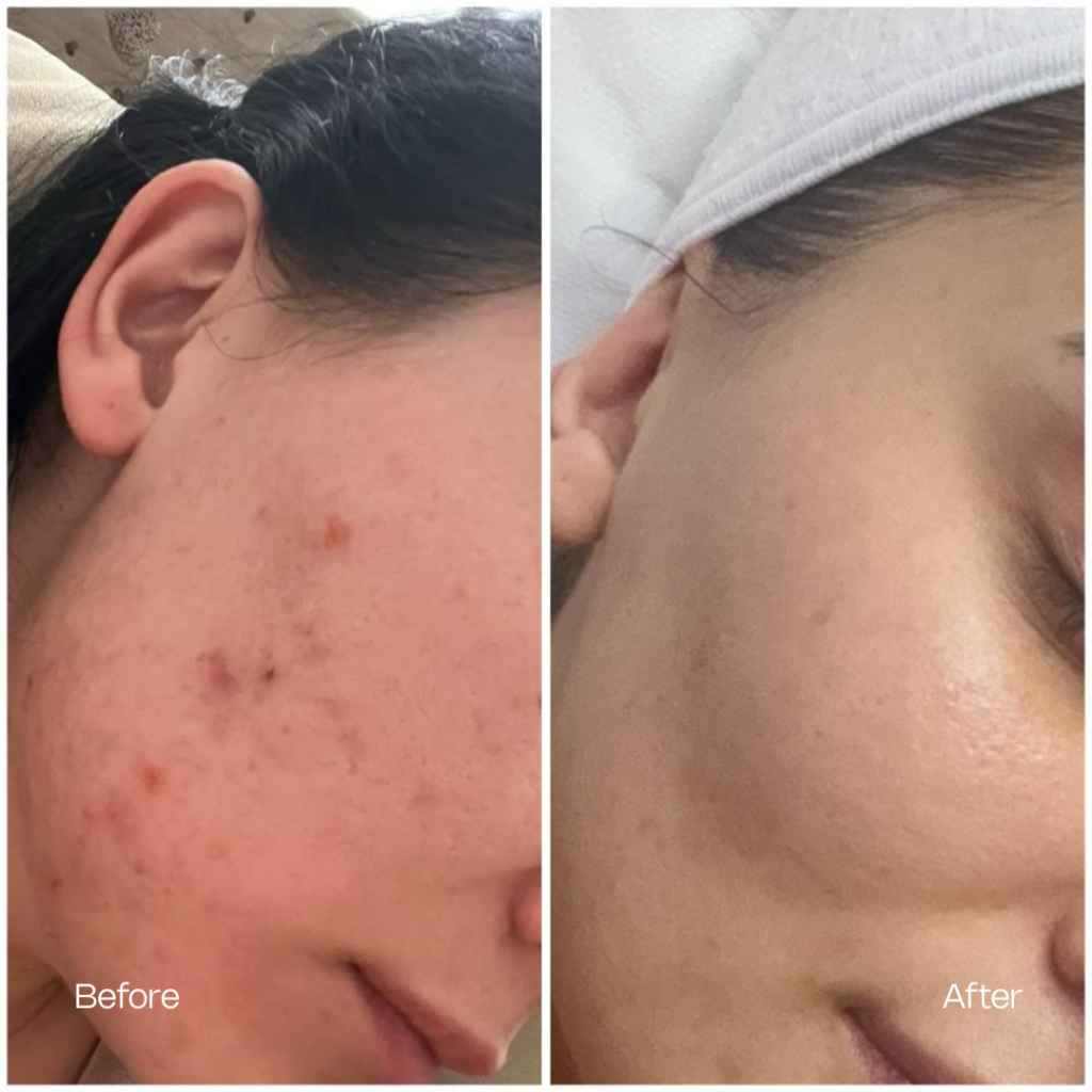 Treatment result 1