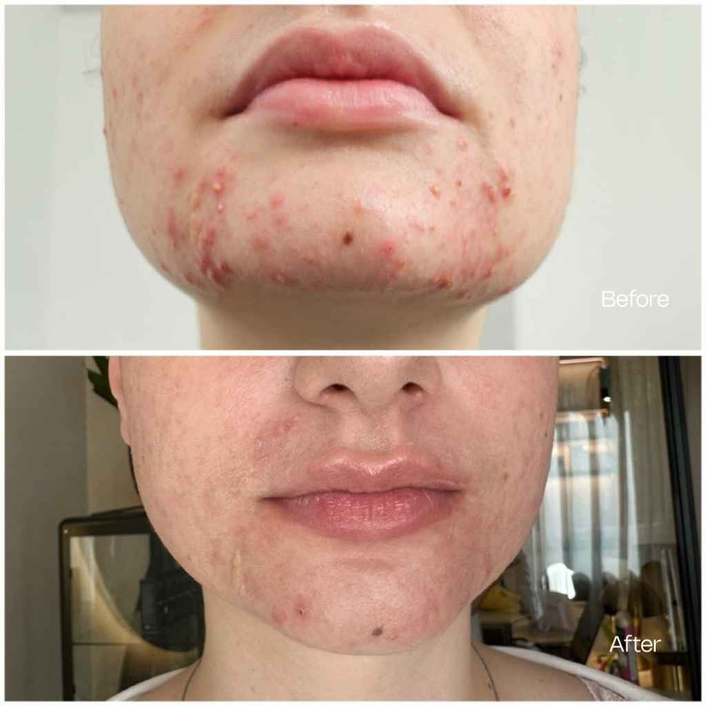 Treatment result 7