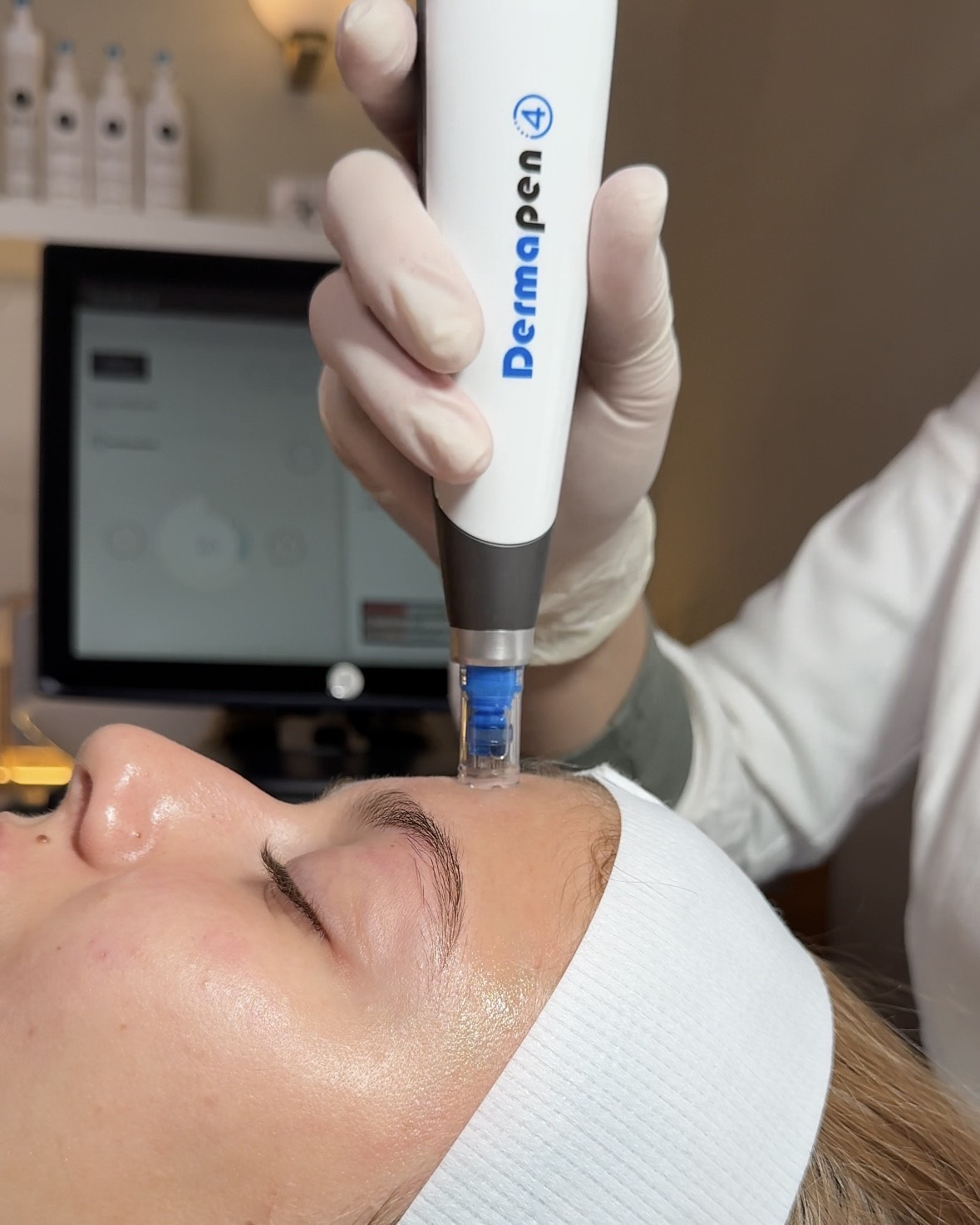 Dermapen 4 treatment at TEUTÉ Advanced Aesthetics, Prishtina