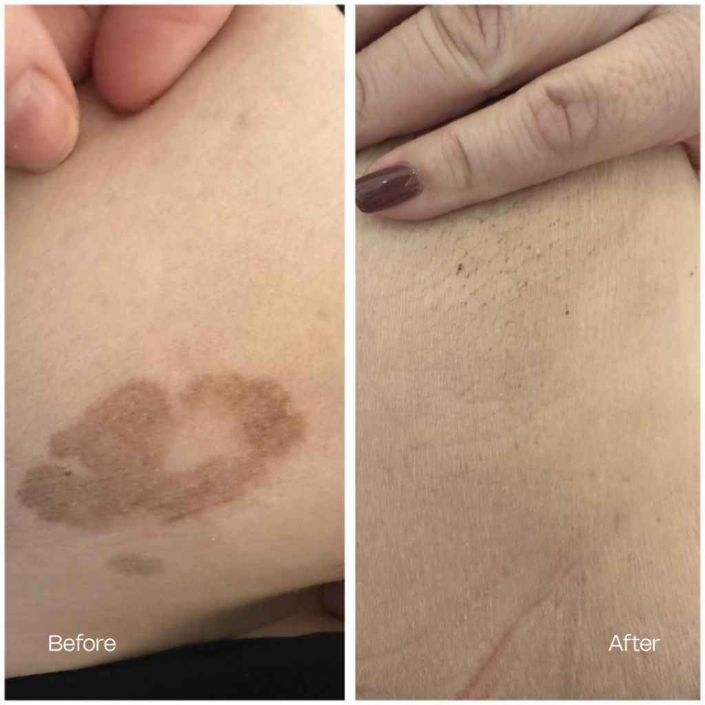 Treatment result 8