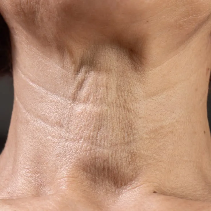 Tech Neck™ nuk është vetëm çështje moshe