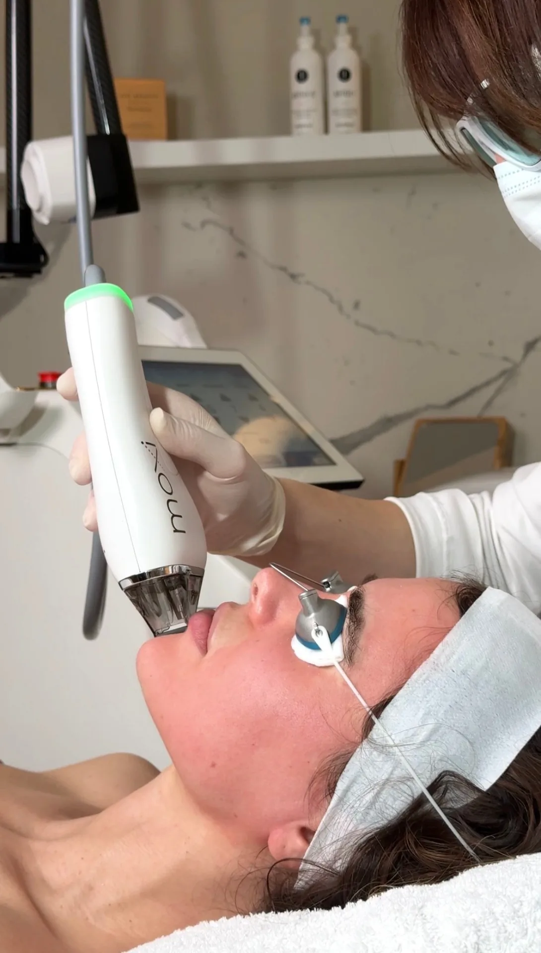 Moxi Laser treatment at TEUTÉ Advanced Aesthetics, Prishtina