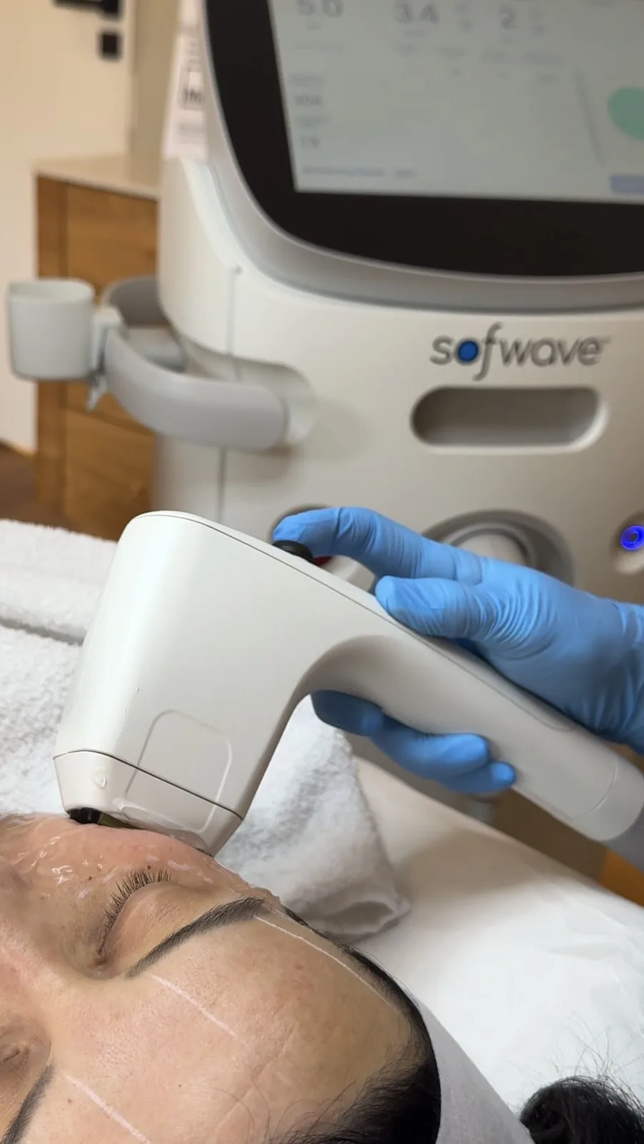 Sofwave treatment at TEUTÉ Advanced Aesthetics, Prishtina